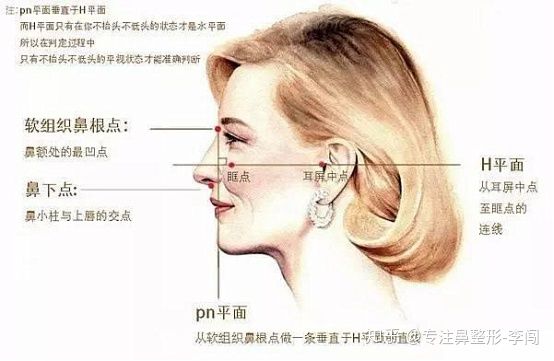 具体细分的话,根据下巴的形态,直面型,凸面型,凹面型又可分别下分为