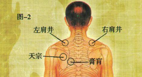 手法:天宗穴具有舒经活络,理气消肿的功效,按摩此穴位治疗落枕的