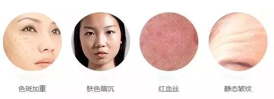 做完光子嫩肤皮肤会反黑吗?