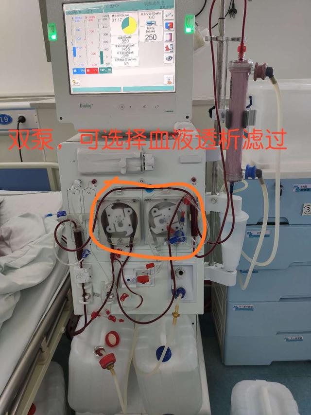 有些地区的血液透析滤过(hdf),血液灌流(hp)不在报销范围内,所以大