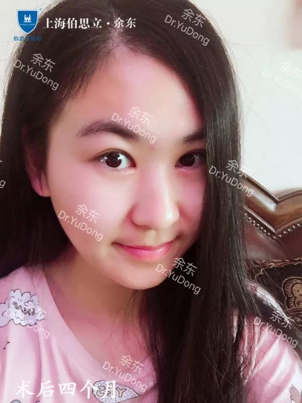 "肿眼泡"怎么办?
