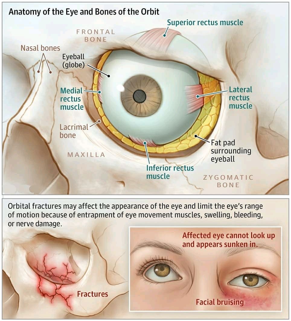 oculareyetrauma