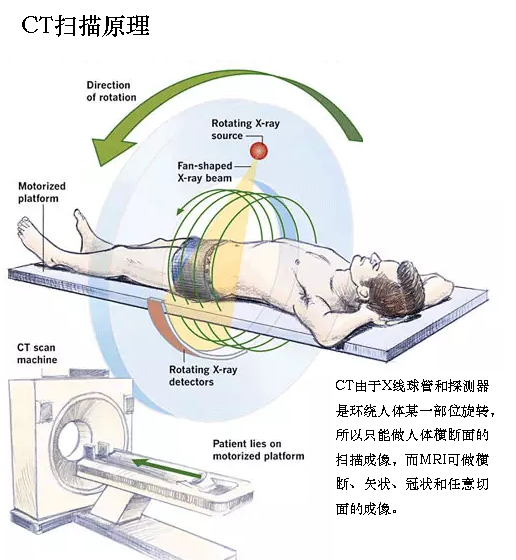 陈谦主任科普之ct检查-陈谦-爱问医生