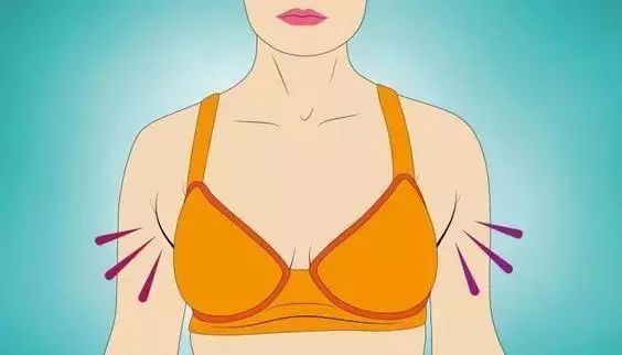 任何乳腺疾病在副乳下均可发生,特别是副乳腺癌发生率高,不仅影响外观