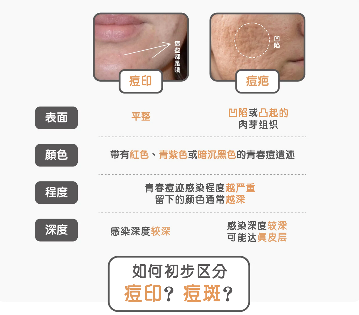 痘疤治療 | 痘疤治療的專家請找莊盈彥醫師，美上美皮膚科是痘疤治療專科診所！莊盈彥醫師專治凹痘疤跟凸痘疤，有任何的痘疤問… | Flickr