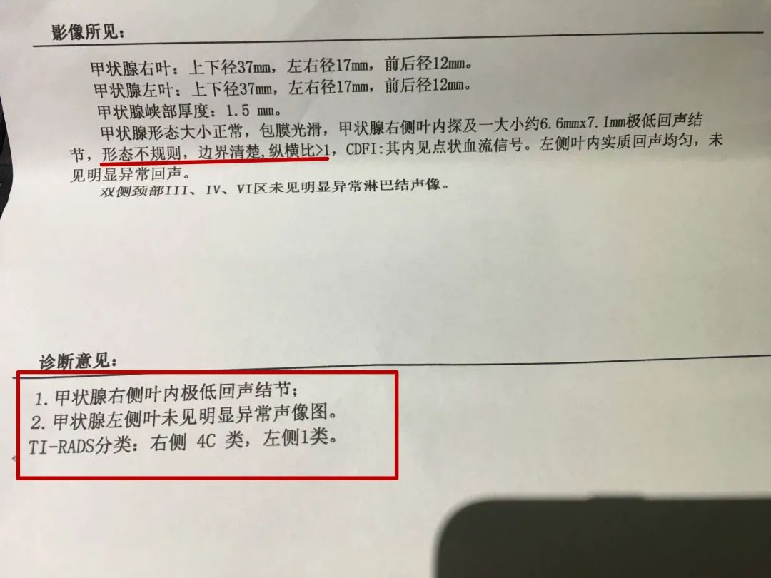 30岁结节病人穿刺基因检测后被确诊为甲状腺癌!