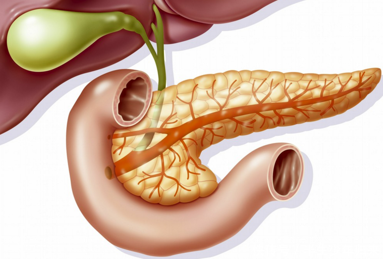 胰身都是病-谈谈慢性胰腺炎的治疗