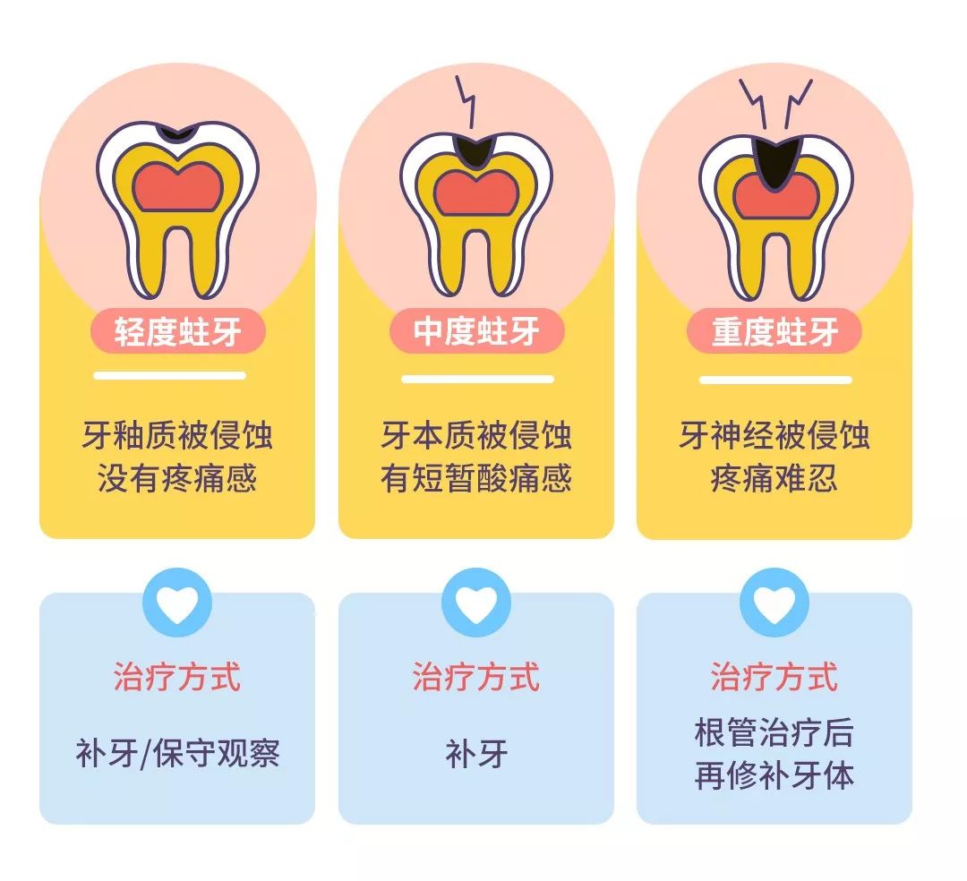 举个栗子 以补牙难度和严重情况来看 浅龋 中龋 深龋,所以处理