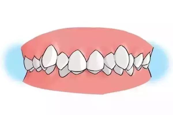 口腔正畸,改变的不仅仅是牙齿,更是你的人生!