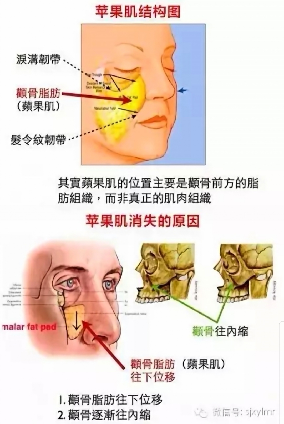 苹果肌还是高颧骨包子脸傻傻的分不清