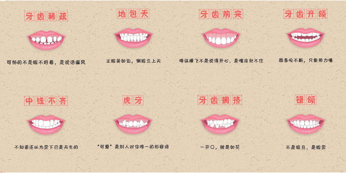 牙齿类型.jpg