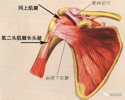 肩关节同时处于内旋位,冈上肌,肱二头肌长头腱以及肩峰下滑囊撞击肩峰
