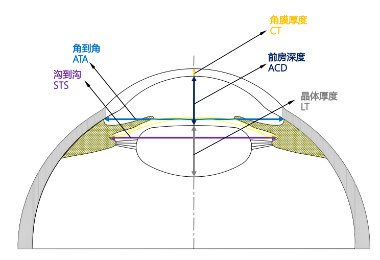 icl晶体植入手术术前都检查哪些项目?