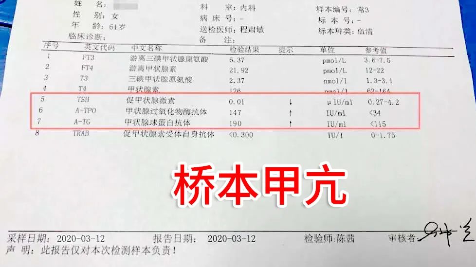 甲亢又是甲癌!脖子肿的像鸡蛋,患者哭诉:我怎么一下得这么多病