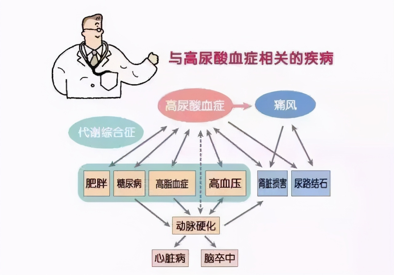 你是不是高尿酸血症最喜欢的人