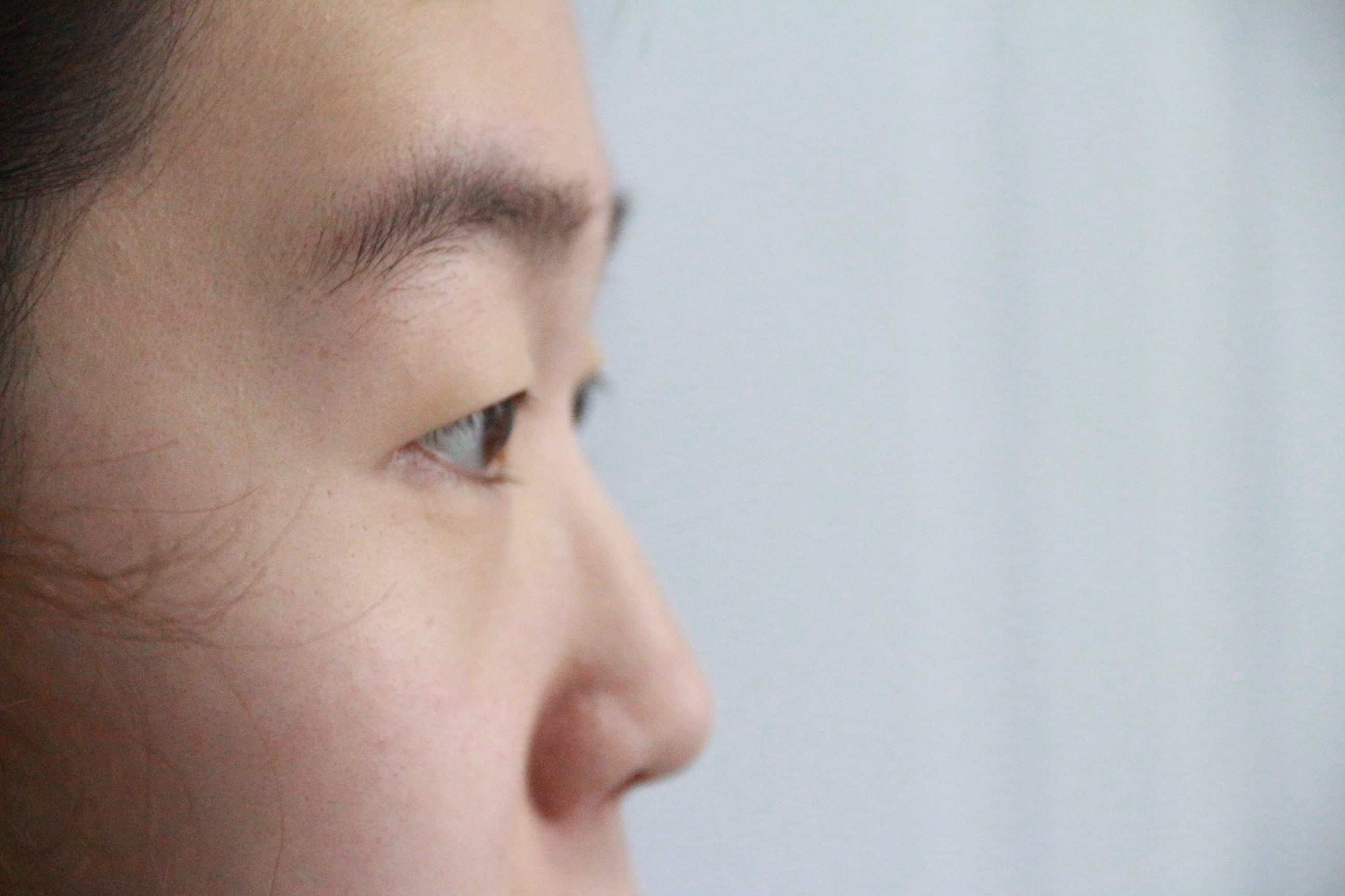 眼整形医生孔宇_新浪博客