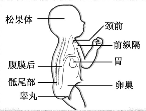 此外,还可长在纵膈,骶尾部,腹膜后,松果体等部位.