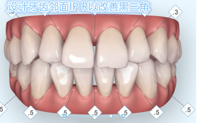 黑三角那点事