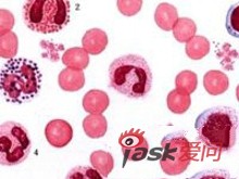 血友病治疗最新进展