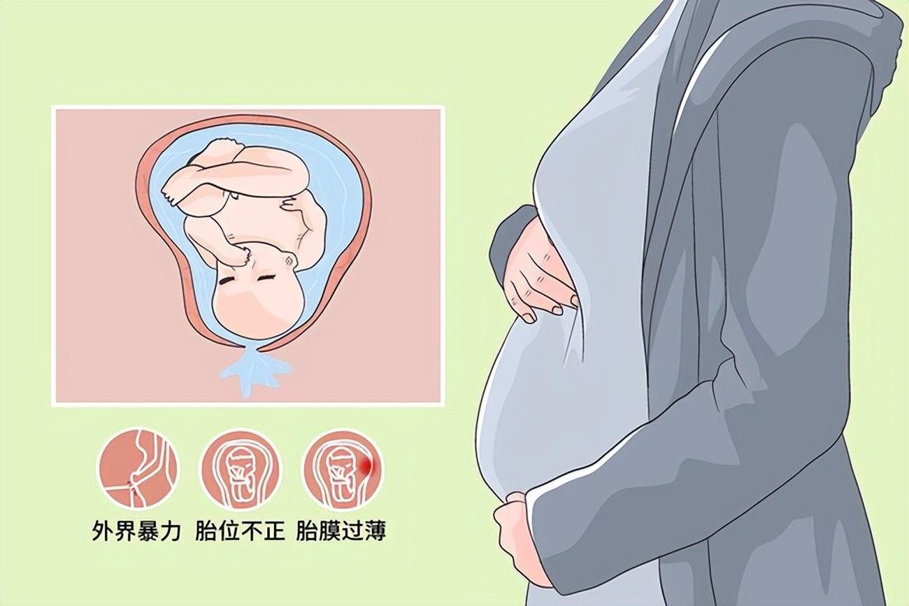 孕妇羊水漏出来的真实图片（临近预产期，这样的破水很容易误认为漏尿，别耽误赶紧去医院） | 说明书网