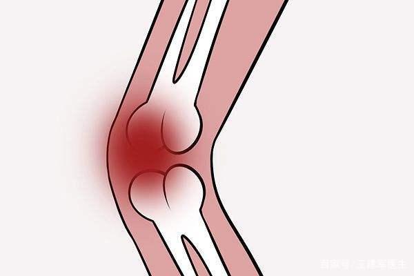 一般情况下膝关节疼痛的时候也会肿胀,关节腔里面会有积液,走路的时候