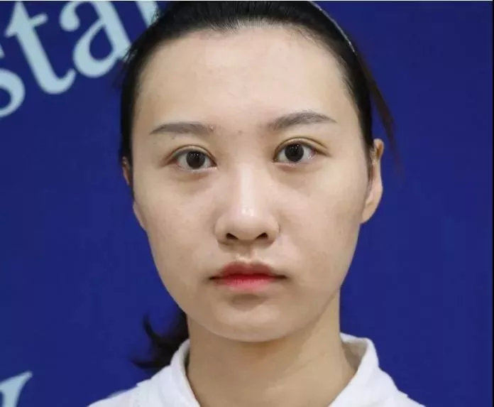 都是做鼻子,为什么收费不一样?