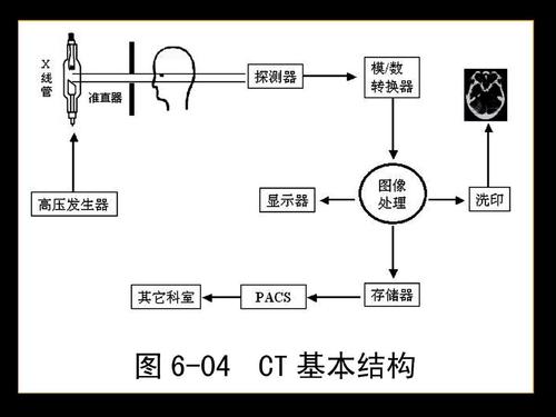 陈谦主任科普之CT检查