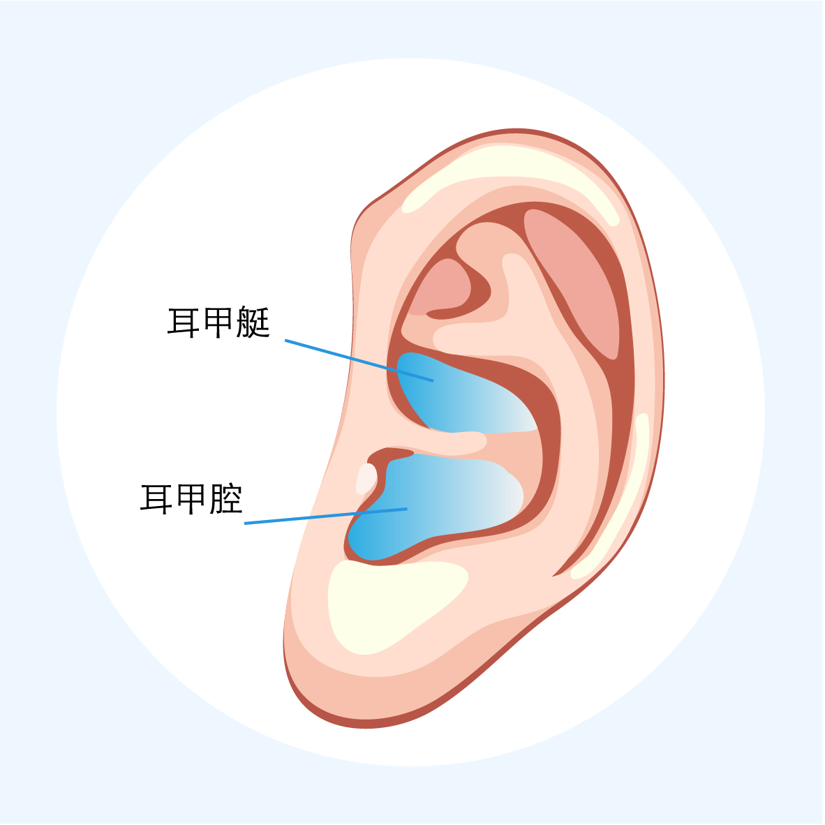 術後佩戴耳模會幫助耳朵輪廓及正常形態的維持.