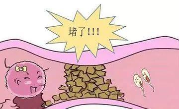 输卵管堵塞吃妇炎丸有用吗