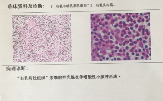 微小RNA获诺贝尔奖哪些企业有相关技术布局？商业前景如何？