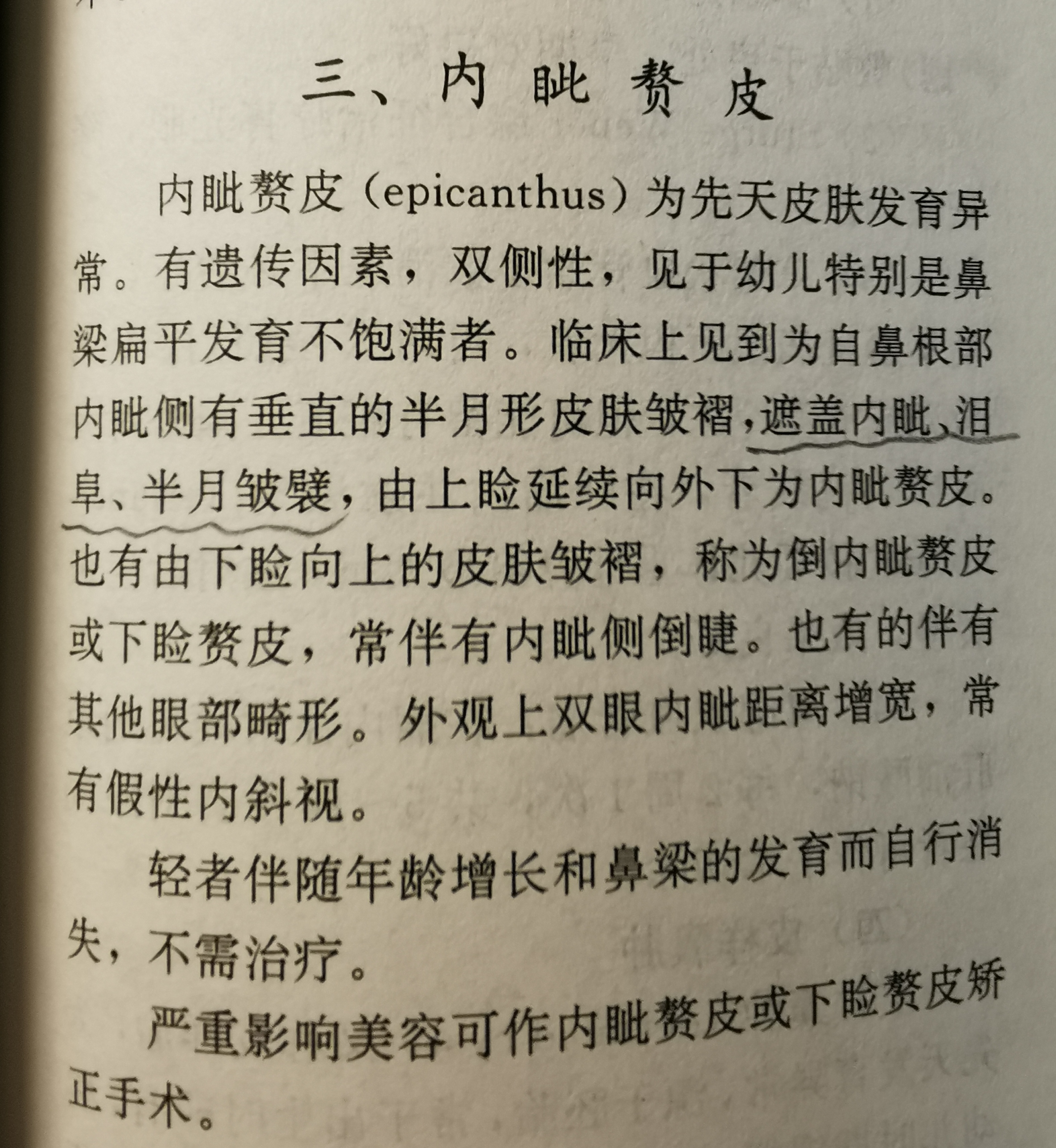 該體徵常見於先天性卵巢發育不全的患者,如turner綜合徵.