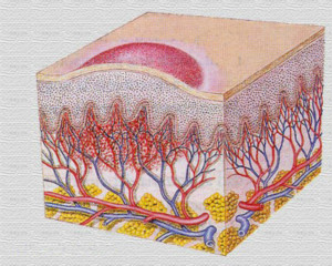血管瘤 | 它需要怎么治?