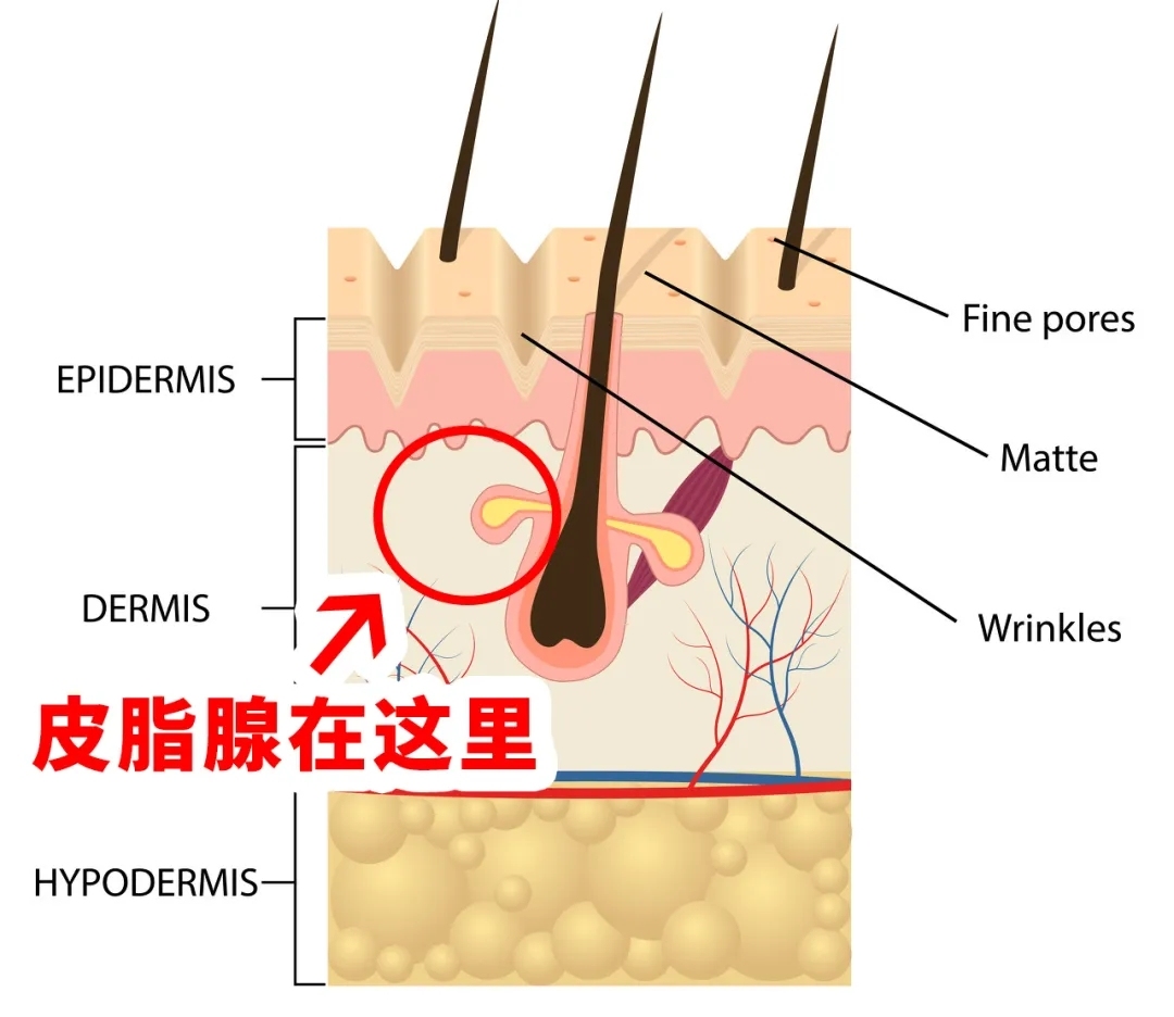 额头等皮脂腺分布较多,出油更旺盛的位置,但也有可能全脸出现