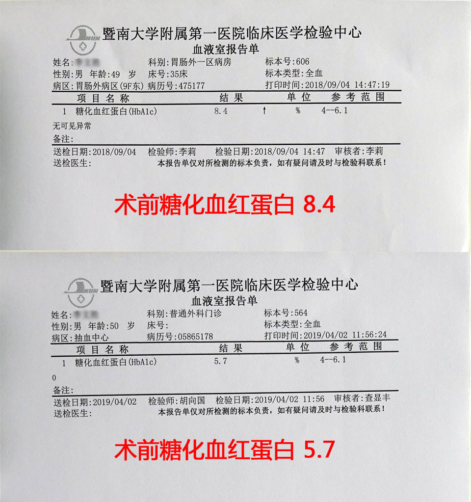 胃旁路手術治療糖尿病效果好不好?以糖化血紅蛋白說了算!