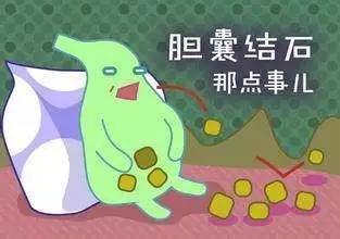 如何预防胆囊结石 远离"疯狂的石头"?