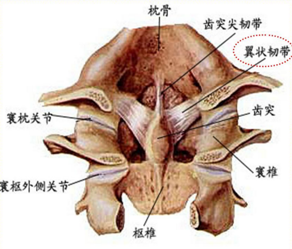 寰枢关节间隙左窄右宽图片