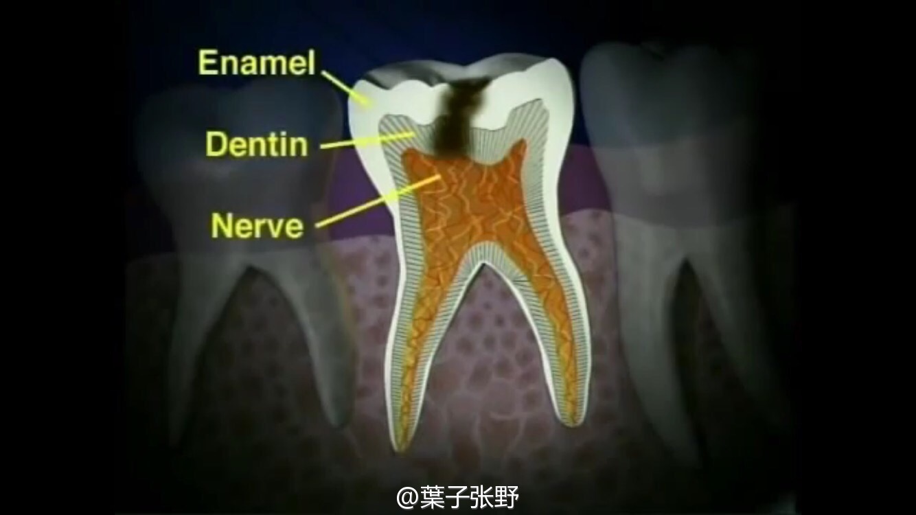 乳牙牙髓切断治疗