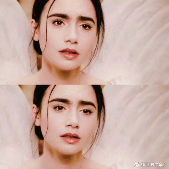 什么眼型适合做欧式双眼皮?