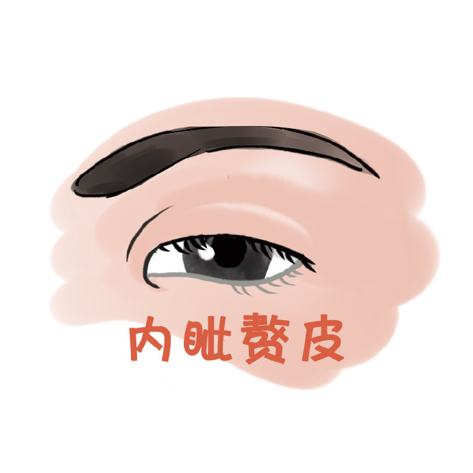 什么样的人适合开内眼角开坏了能修复吗