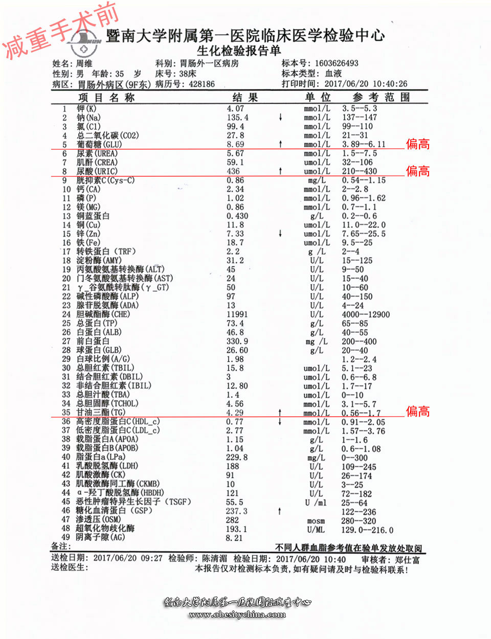 糖尿病手術後三個月,複查結果顯示糖尿病已成過去