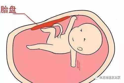 胎盘血池图片