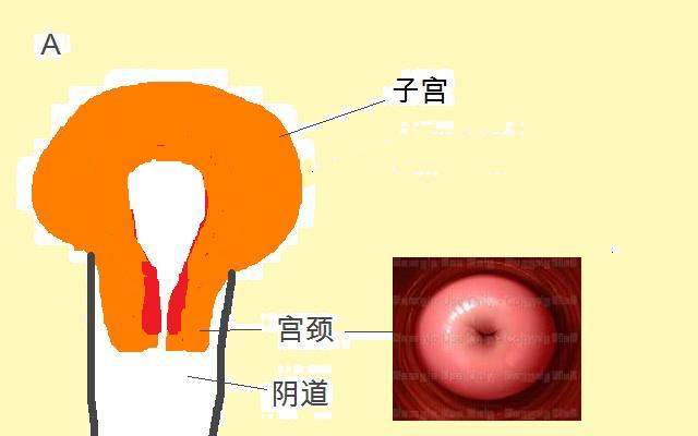 女性排卵期宫颈图片图片