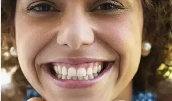 这几种类型牙齿都需要矫正.你的牙齿需要矫正吗?