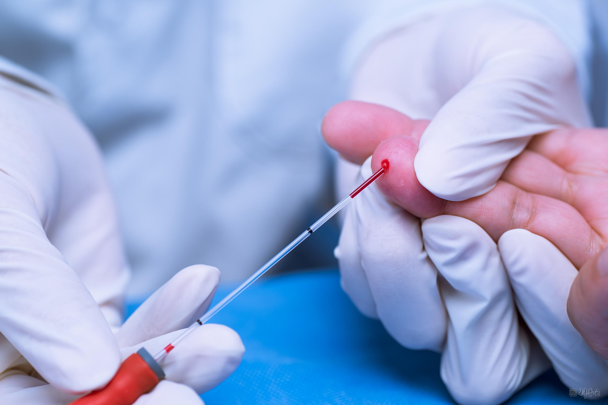 一滴血测癌这些医疗健康类谣言你能识破吗