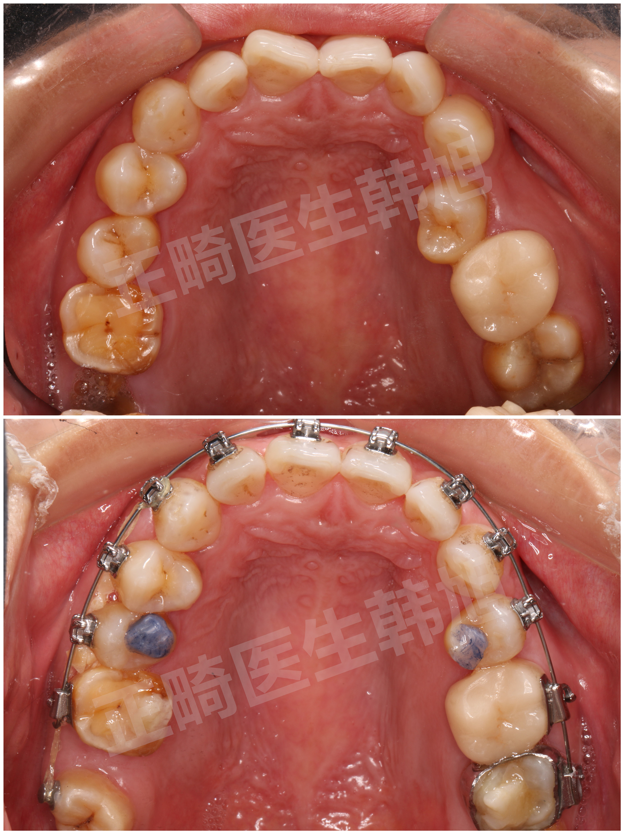 正畸9张照片图片图片