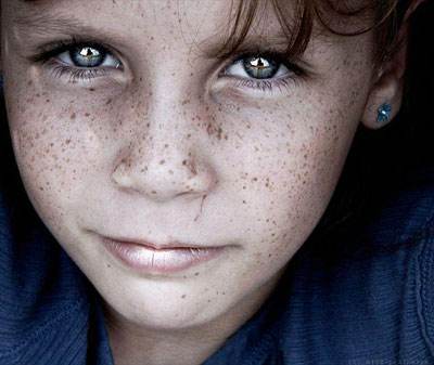 随着年龄的增长很多人的面部因为种种原因出现了与正常皮肤颜色不同的
