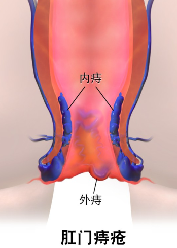 怎么能把自己玩到脱肛图片