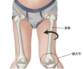 第二,让孩子坐着(以膝盖朝着正前方姿势坐着),看内踝和外踝的前后