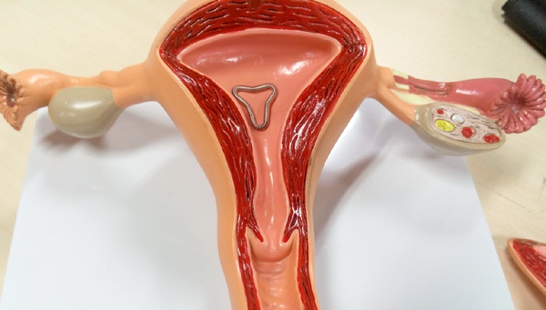 上环节育——时代的烙印,女性的悲哀!