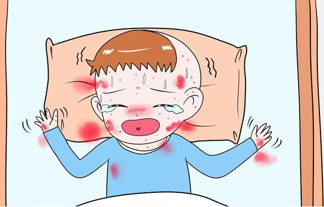 关于紫癜性肾炎并发症知多少